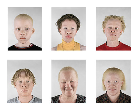 albinos.jpg